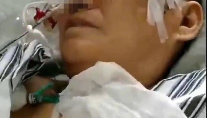 六旬老人遭狩猎者枪击致重伤，开枪者两次逃离现场，事发4小时后冒充“好心人”施救，家属：耽误了最佳救治时间
