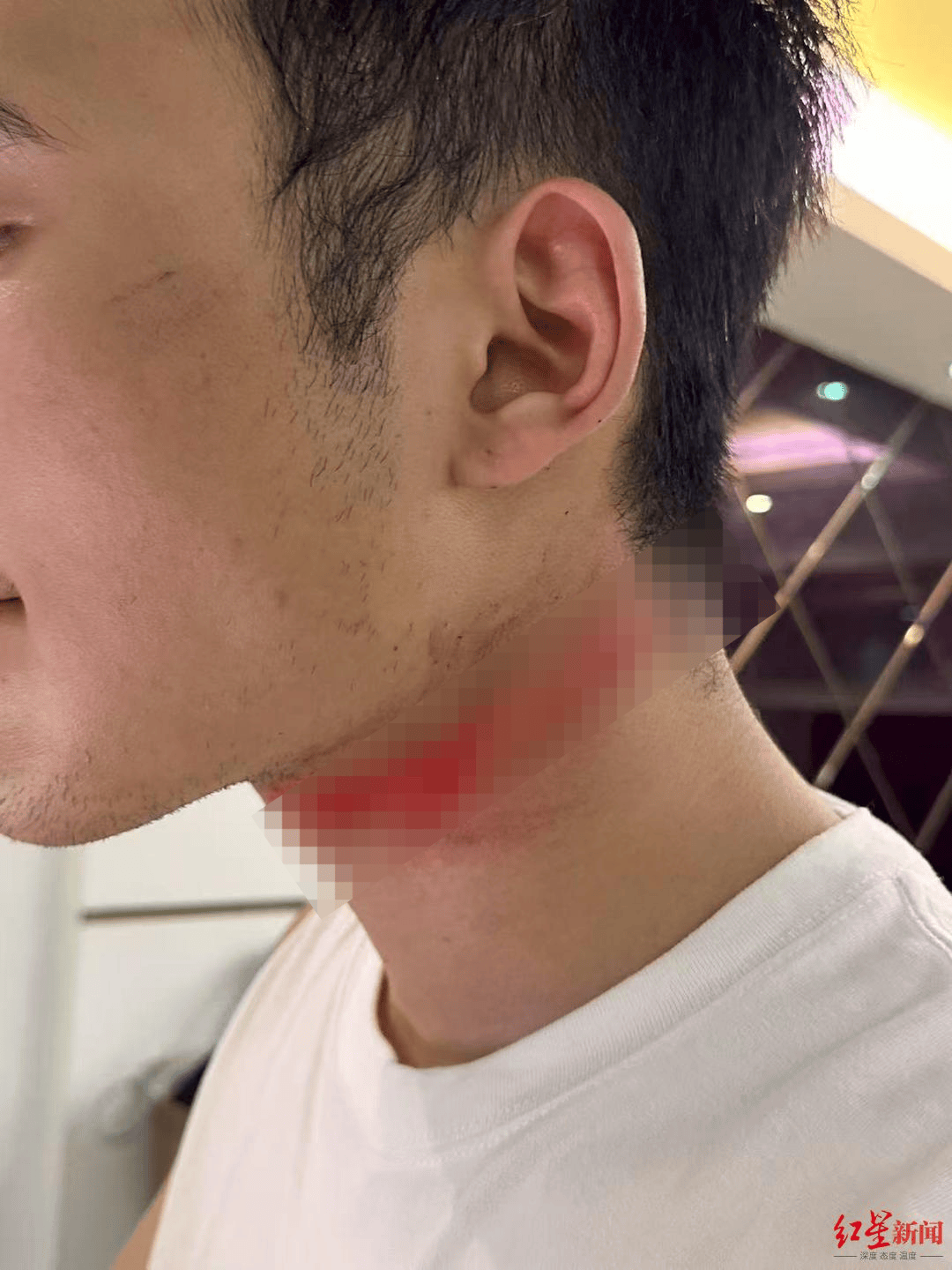 男主播骑车载女友回家被路边掉落网线勒伤脖子，索赔3万陷僵局 律师解读该谁赔