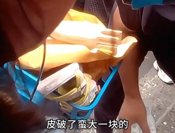 看着都疼！上海街头一男子突然求助：10岁女儿被死死卡住！这个行为太危险→